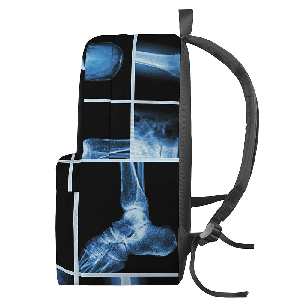 X-Ray Film Radiology Print Backpack