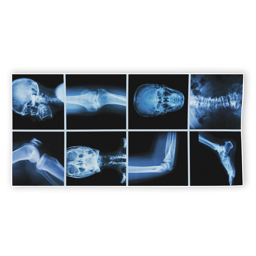 X-Ray Film Radiology Print Beach Towel