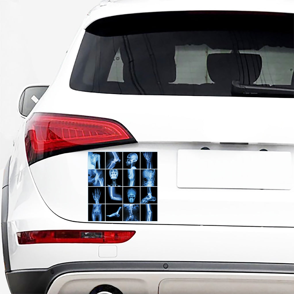 X-Ray Film Radiology Print Car Sticker