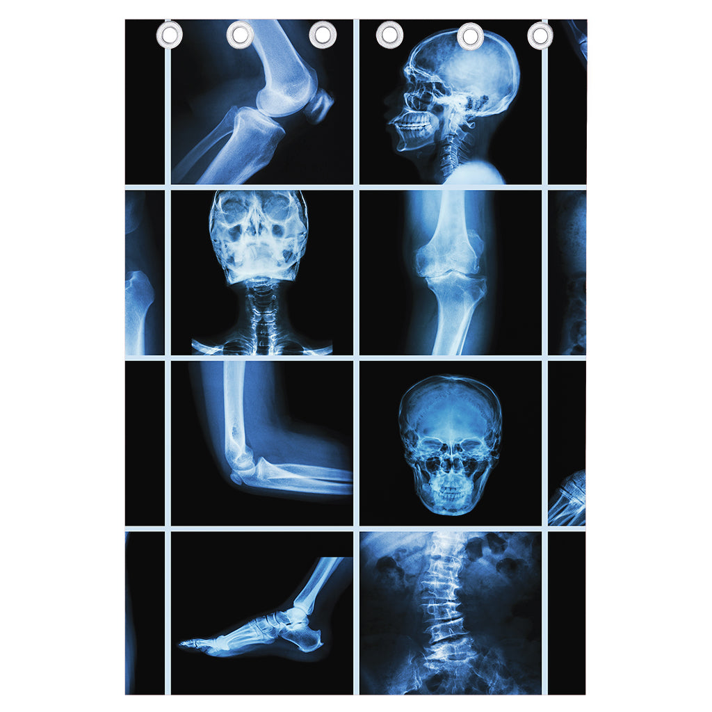 X-Ray Film Radiology Print Curtain