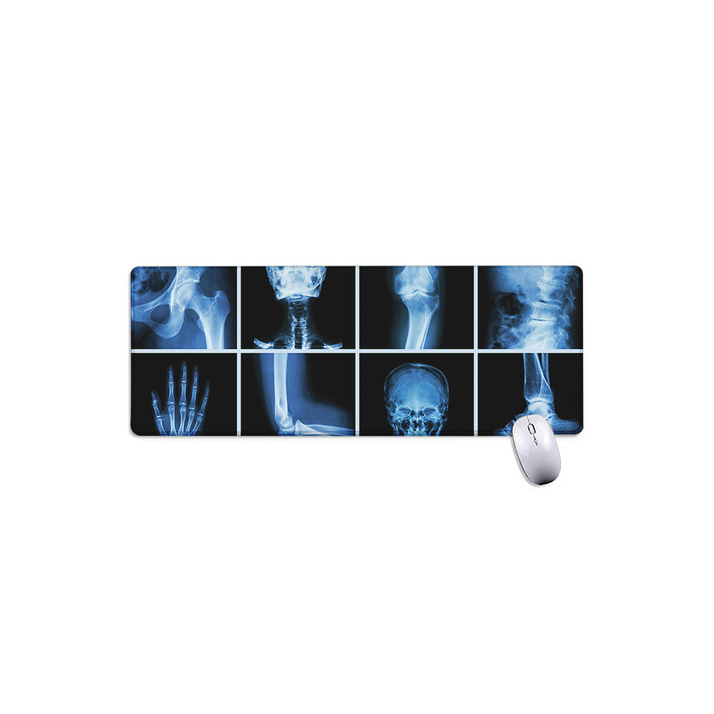 X-Ray Film Radiology Print Extended Mouse Pad
