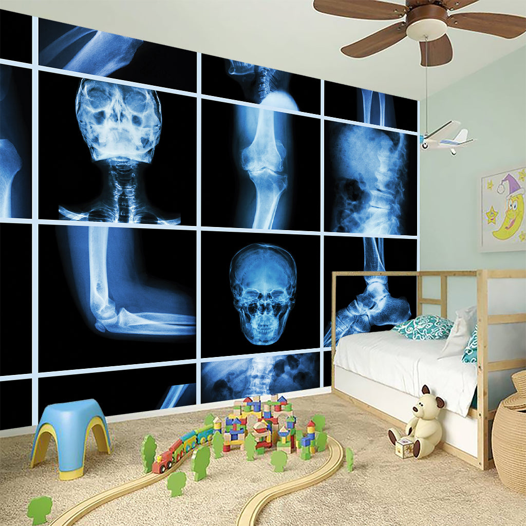 X-Ray Film Radiology Print Wall Sticker