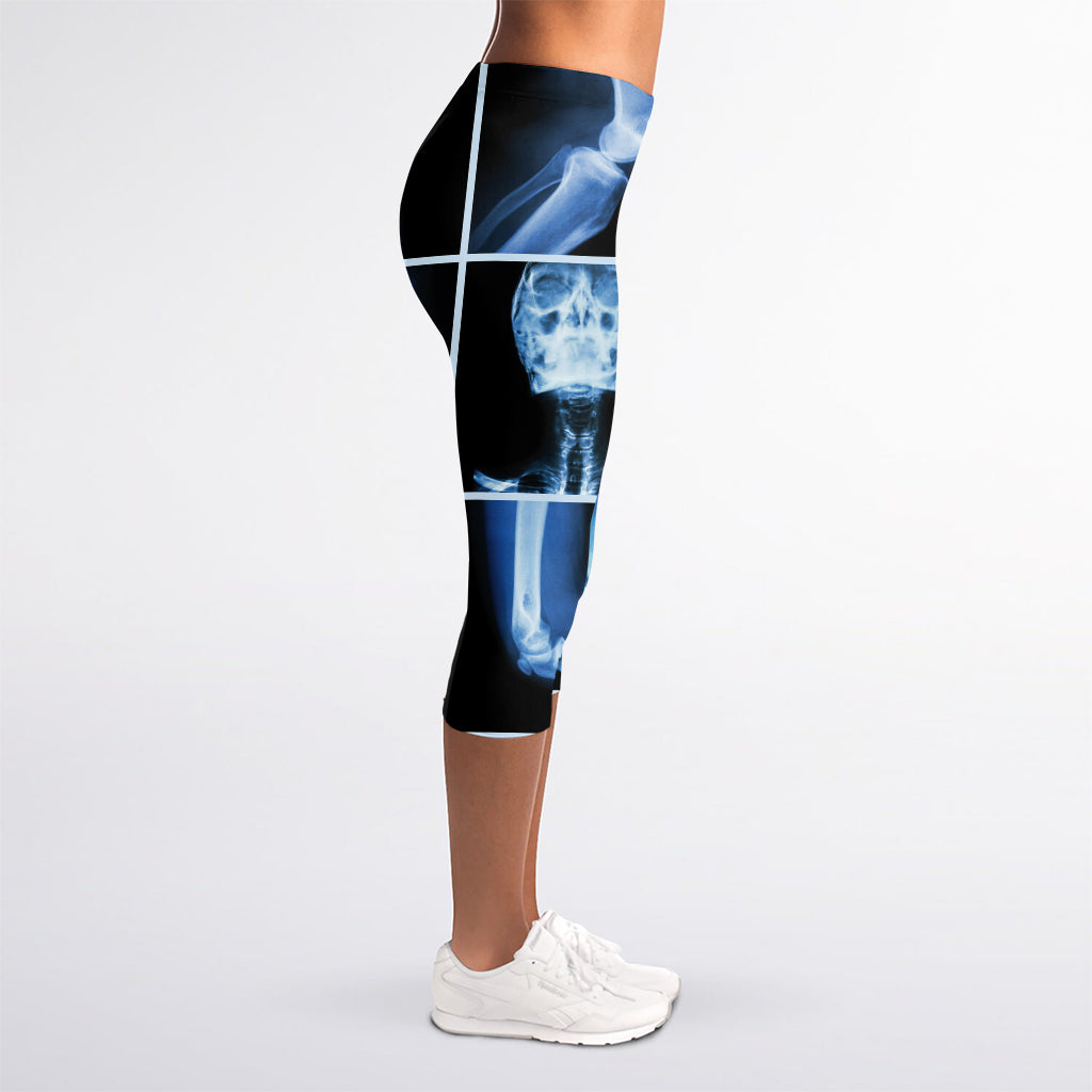 X-Ray Film Radiology Print Women's Capri Leggings
