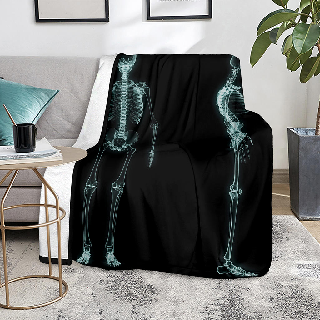 Human Skeleton X-Ray Print Blanket