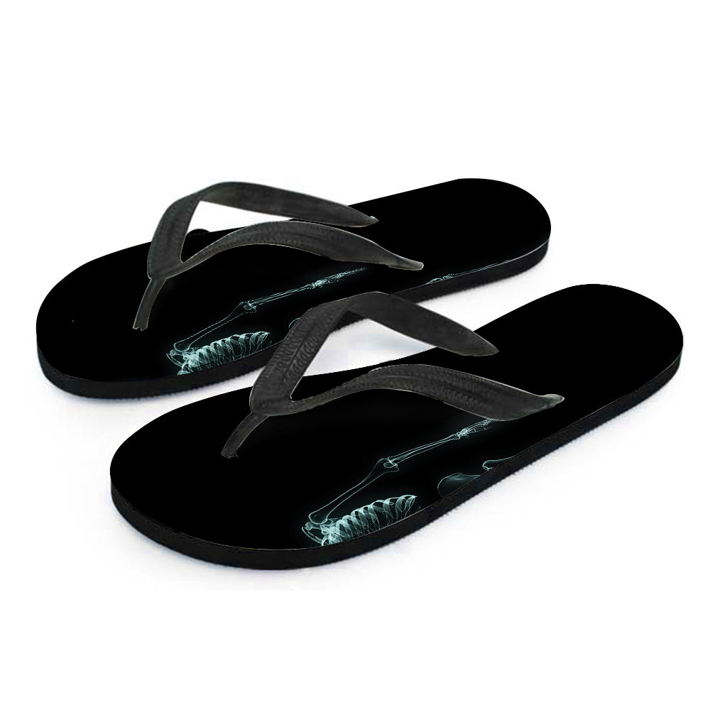 Human Skeleton X-Ray Print Flip Flops