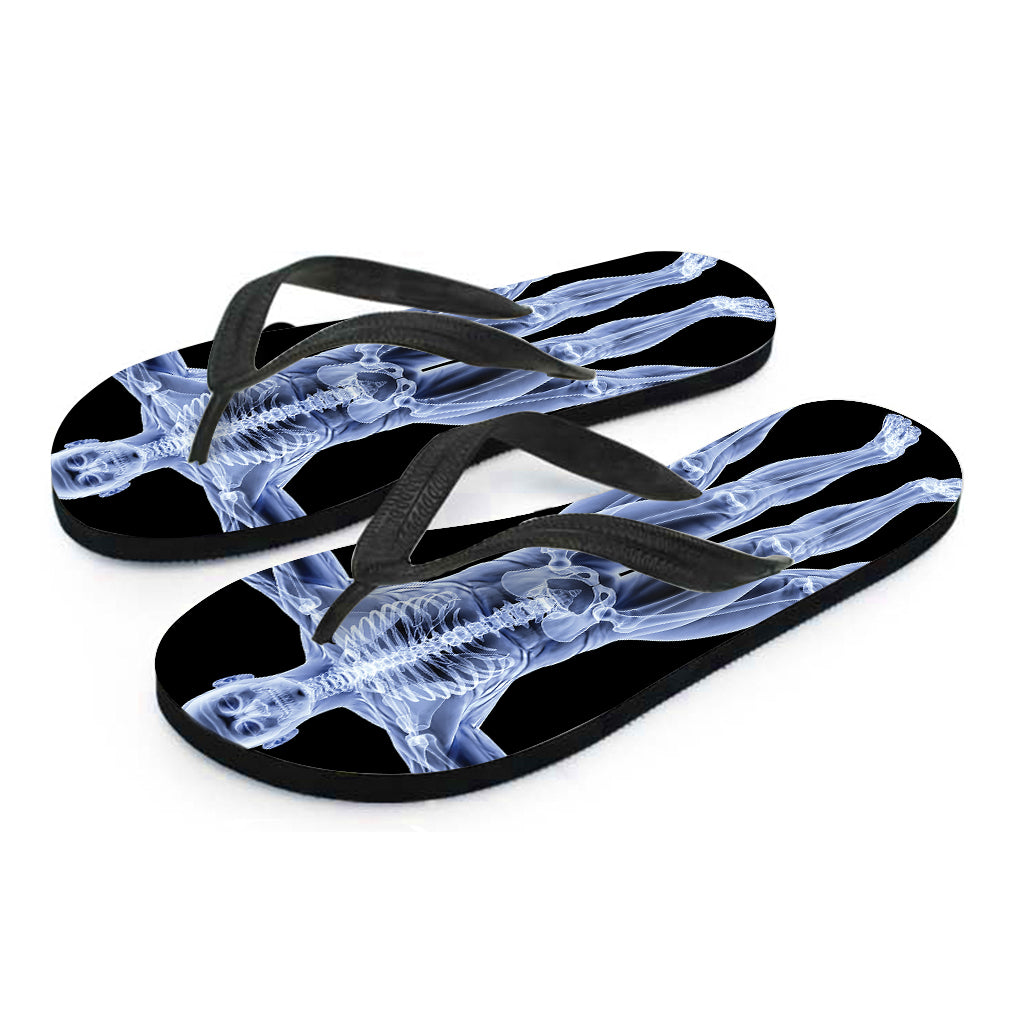 Vitruvian Man X-Ray Print Flip Flops