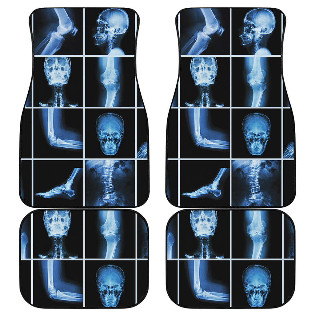 X-Ray Film Radiology Print Front and Back Car Floor Mats