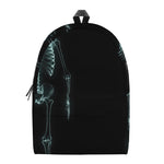 Human Skeleton X-Ray Print Backpack