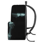 Human Skeleton X-Ray Print Backpack