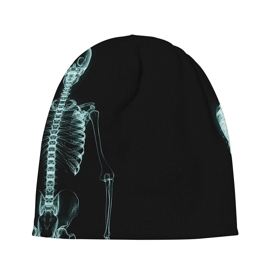 Human Skeleton X-Ray Print Beanie