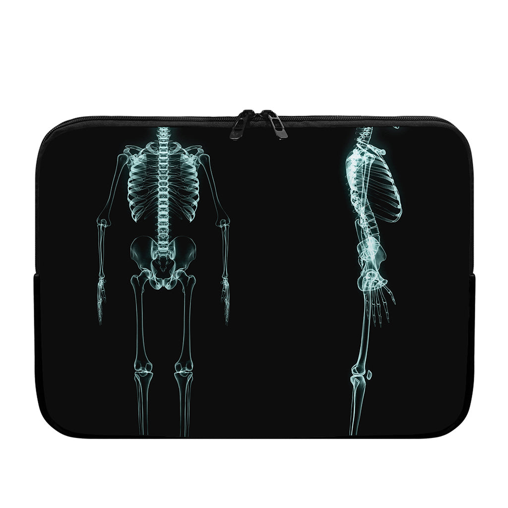 Human Skeleton X-Ray Print Laptop Sleeve
