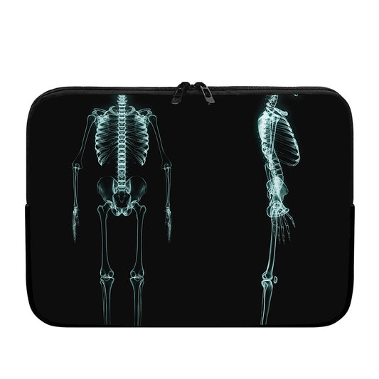 Human Skeleton X-Ray Print Laptop Sleeve