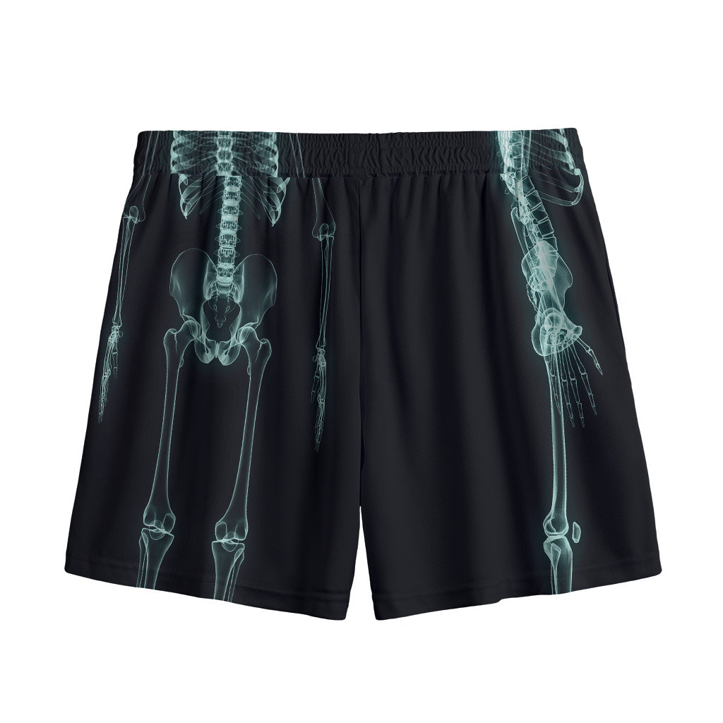 Human Skeleton X-Ray Print Mesh Shorts