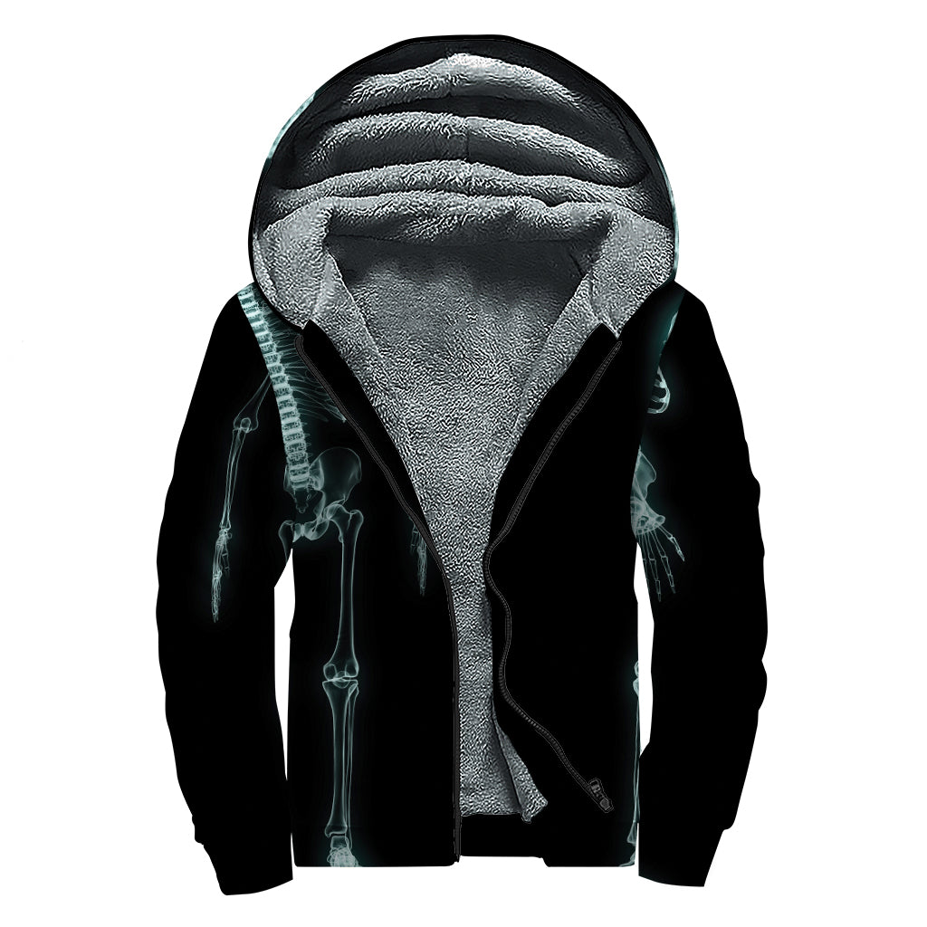 Human Skeleton X-Ray Print Sherpa Lined Zip Up Hoodie