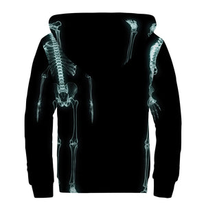 Human Skeleton X-Ray Print Sherpa Lined Zip Up Hoodie