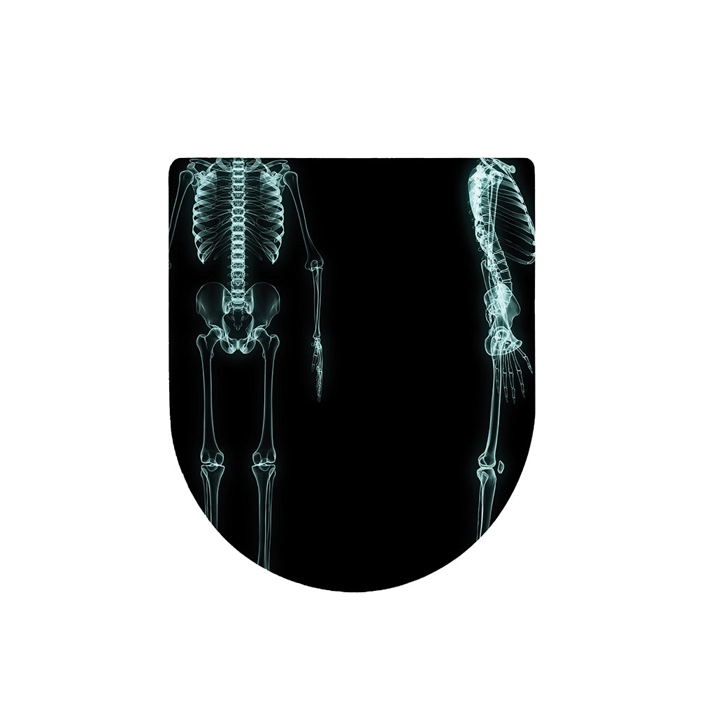 Human Skeleton X-Ray Print Toilet Lid Cover