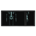 Human Skeleton X-Ray Print Trifold Wallet