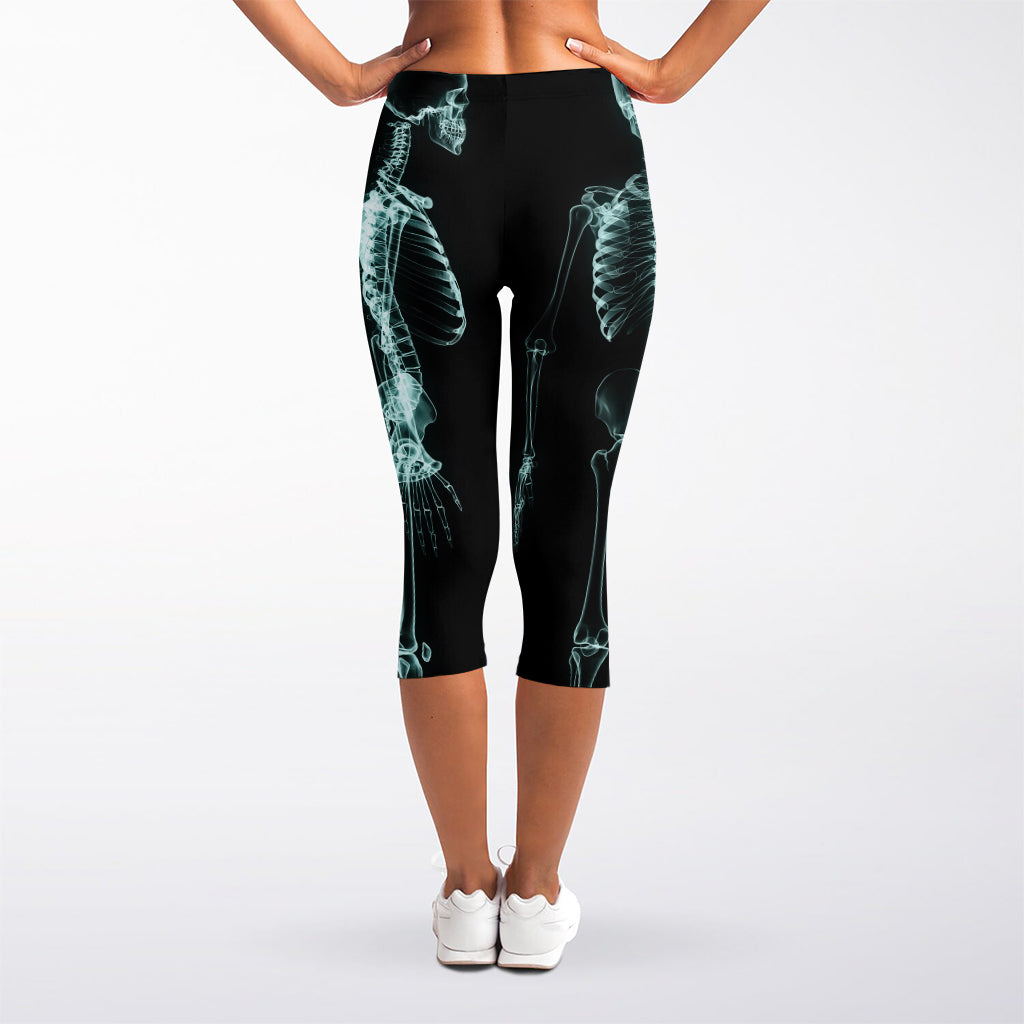 Human Skeleton X-Ray Print Women's Capri Leggings