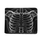 Radiologist X-Ray Film Print Bifold Wallet