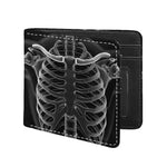 Radiologist X-Ray Film Print Bifold Wallet