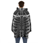 Radiologist X-Ray Film Print Hoodie Blanket