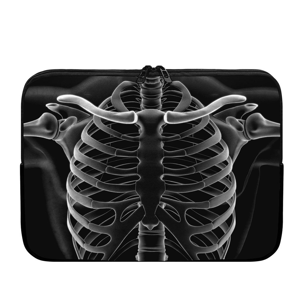 Radiologist X-Ray Film Print Laptop Sleeve