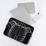 Radiologist X-Ray Film Print Laptop Sleeve