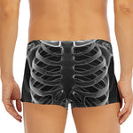 Radiologist X-Ray Film Print Men's Short Boxer Briefs