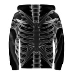 Radiologist X-Ray Film Print Sherpa Lined Zip Up Hoodie