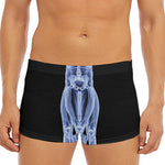 Vitruvian Man X-Ray Print Men's Short Boxer Briefs