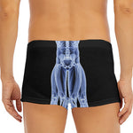 Vitruvian Man X-Ray Print Men's Short Boxer Briefs