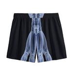Vitruvian Man X-Ray Print Mesh Shorts