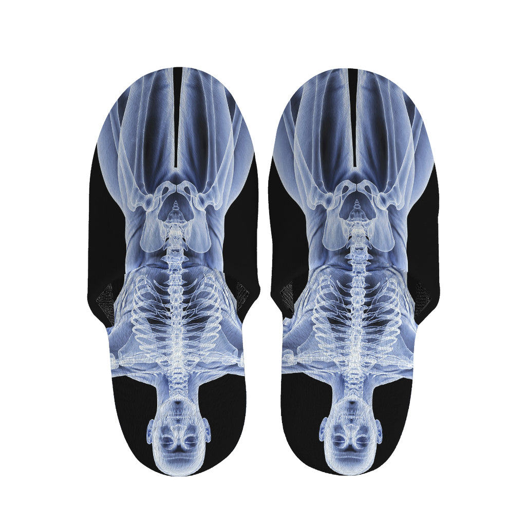 Vitruvian Man X-Ray Print Slippers