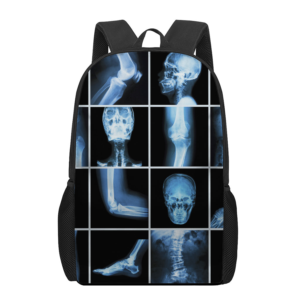 X-Ray Film Radiology Print 17 Inch Backpack