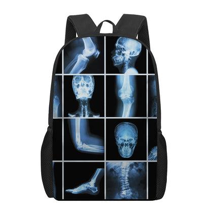 X-Ray Film Radiology Print 17 Inch Backpack