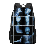 X-Ray Film Radiology Print 17 Inch Backpack
