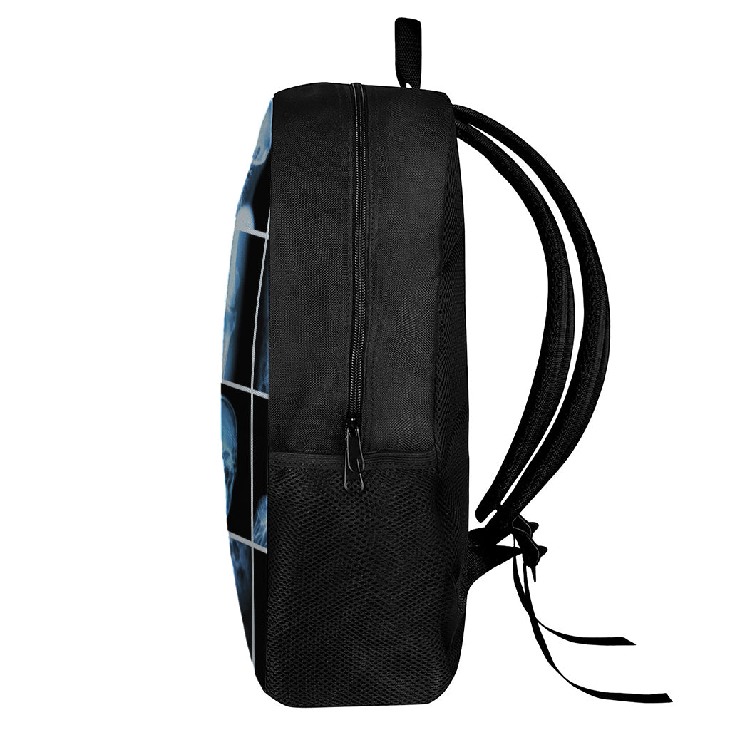X-Ray Film Radiology Print 17 Inch Backpack