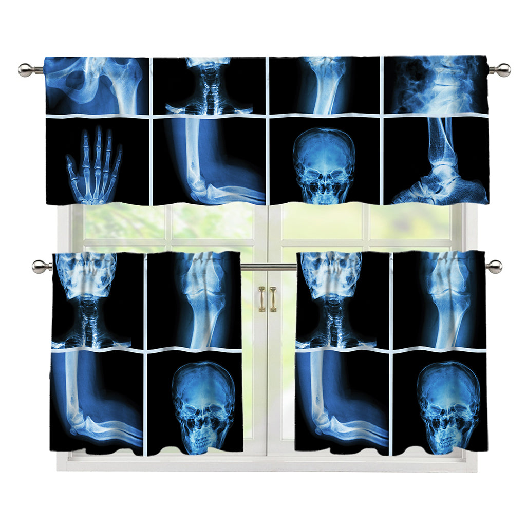 X-Ray Film Radiology Print 3 Piece Kitchen Curtains