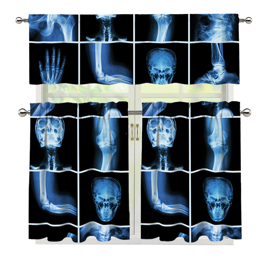 X-Ray Film Radiology Print 3 Piece Kitchen Curtains