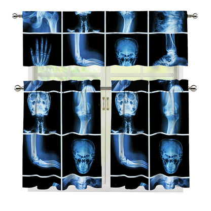 X-Ray Film Radiology Print 3 Piece Kitchen Curtains