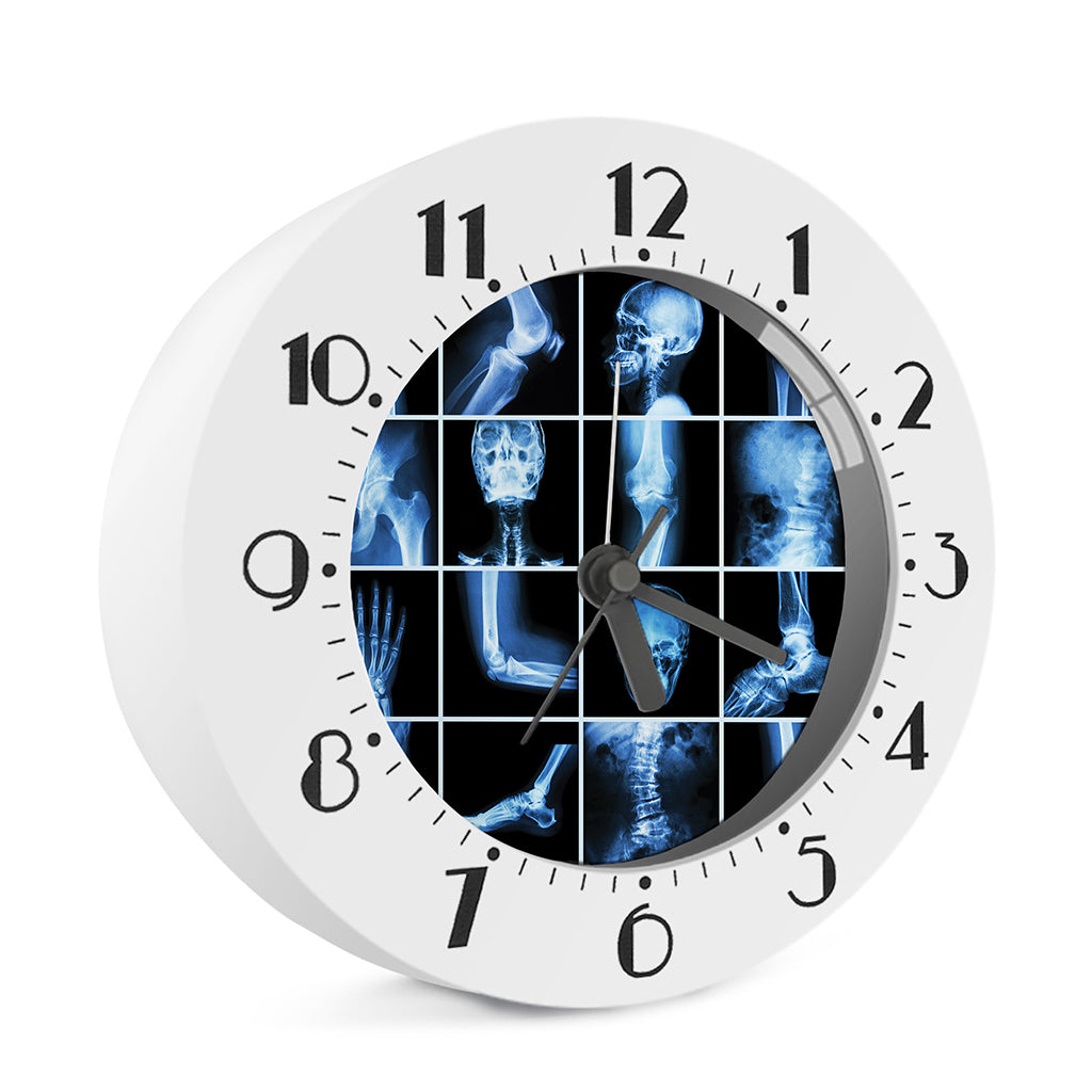 X-Ray Film Radiology Print Alarm Clock