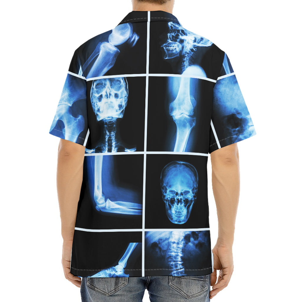 X-Ray Film Radiology Print Aloha Shirt