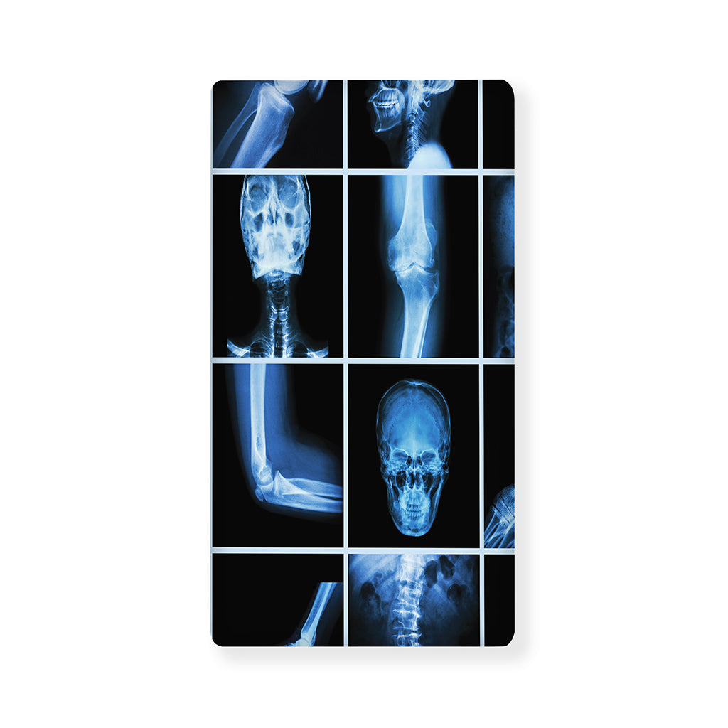 X-Ray Film Radiology Print Baby Crib Sheet