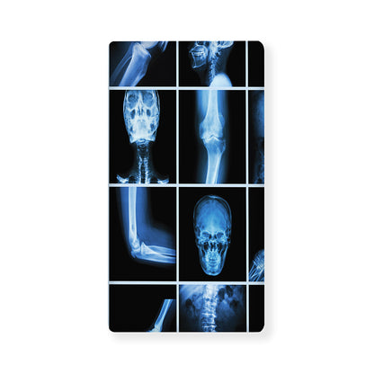 X-Ray Film Radiology Print Baby Crib Sheet
