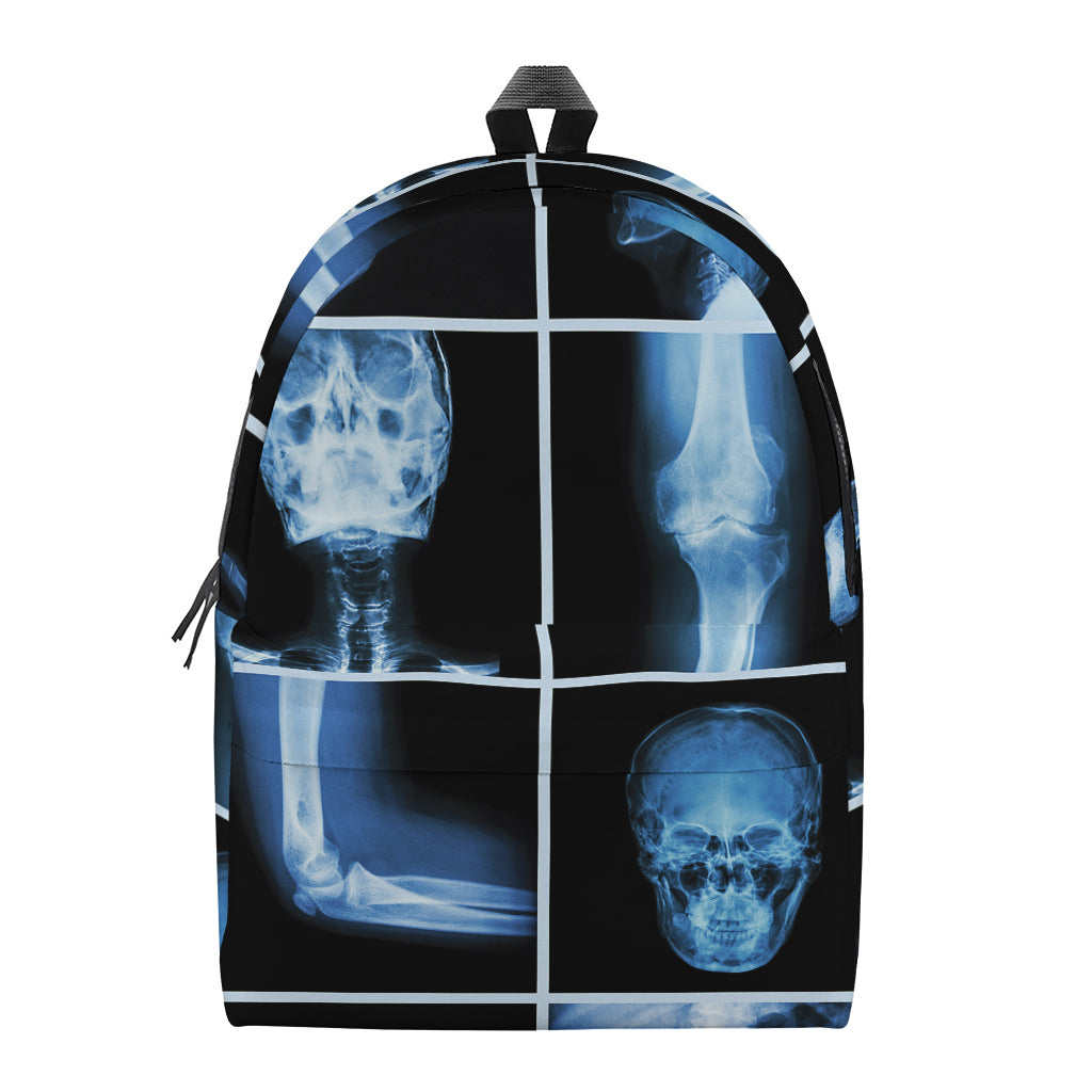 X-Ray Film Radiology Print Backpack