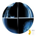X-Ray Film Radiology Print Basketball