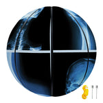 X-Ray Film Radiology Print Basketball