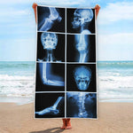 X-Ray Film Radiology Print Beach Towel