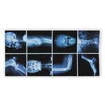 X-Ray Film Radiology Print Beach Towel