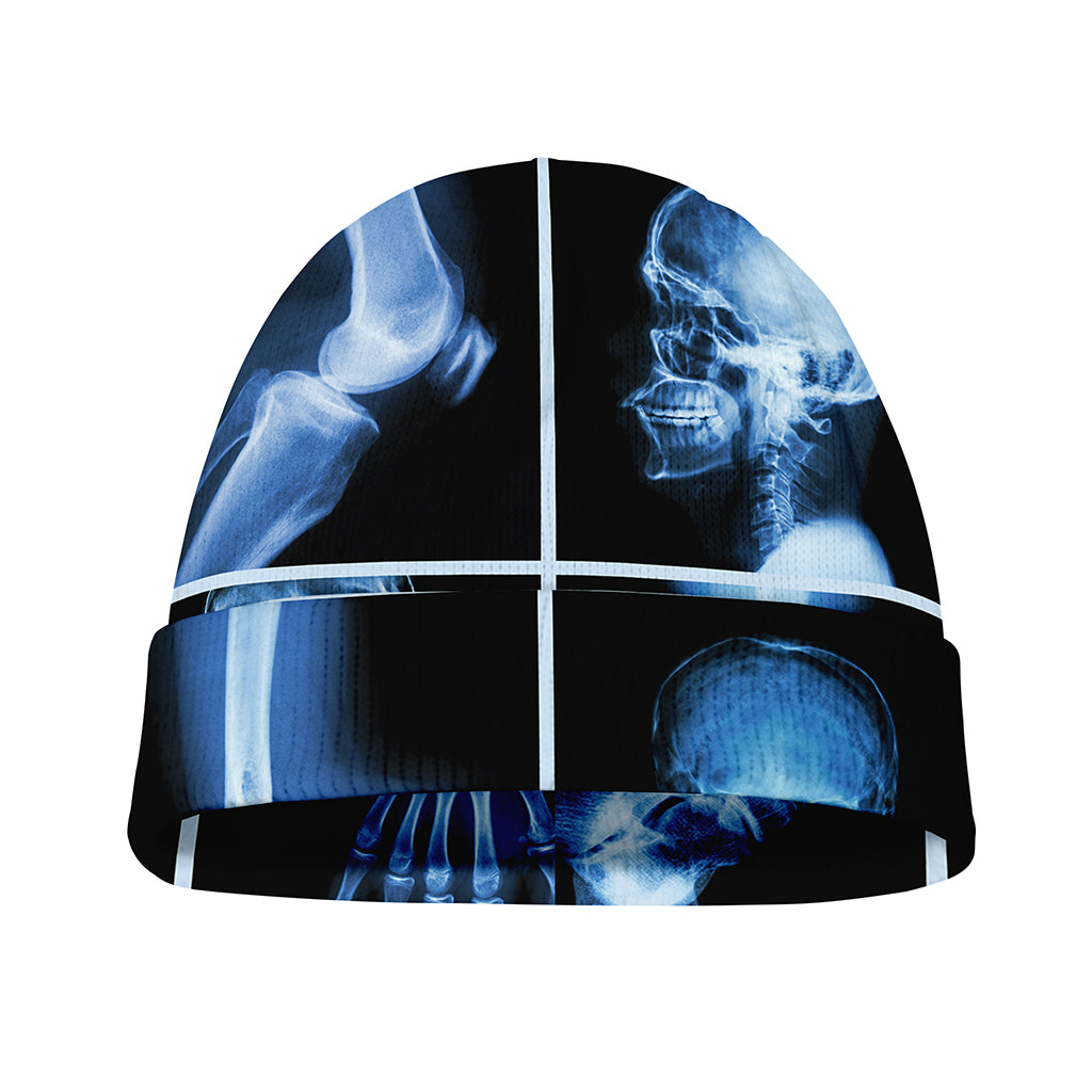 X-Ray Film Radiology Print Beanie